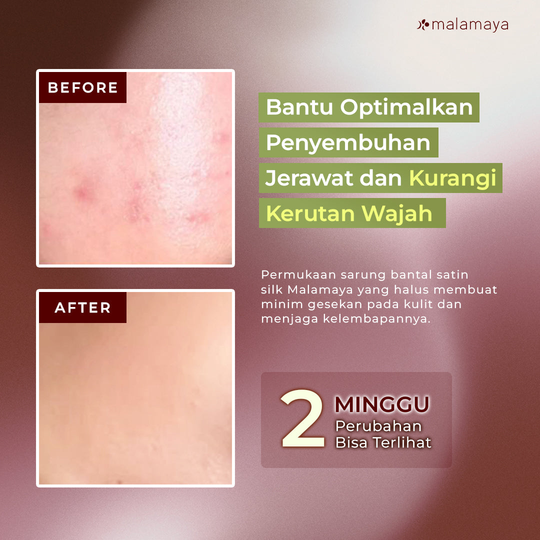 Malamaya - Sarung Bantal Premium Satin Silk Beauty Pillowcase